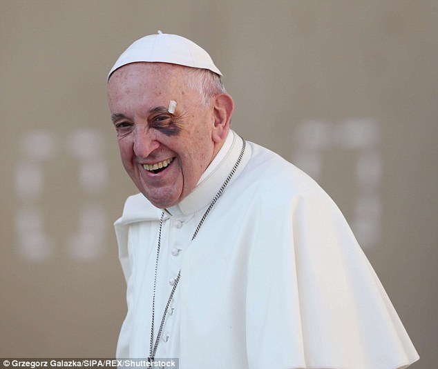 Папу заметили с синяком под левым глазом в 2017 году