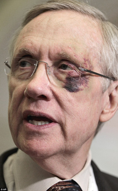 Гарри Рид был изображен с синяком вокруг левого глаза в 2011 году