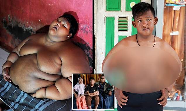 Самый толстый ребенок в мире потерял половину своего веса