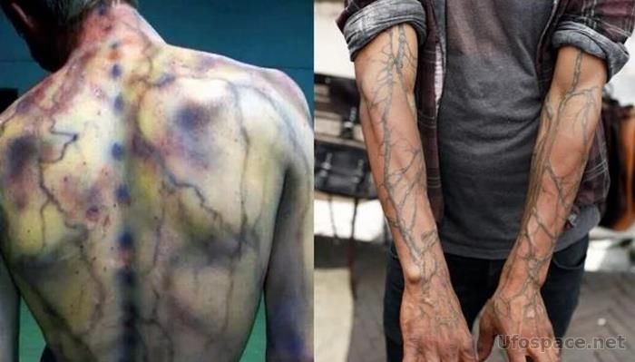 Керанография: Татуировку наносит молния