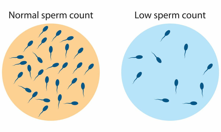 COVID-19 связан с долгосрочным снижением качества спермы