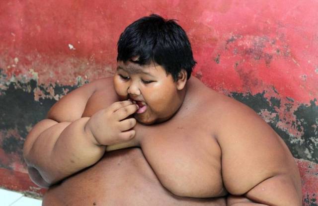 Арья Пермана - самый толстый ребенок в мире
