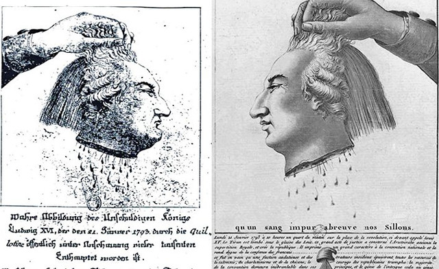 Отрубленная голова Людовика XVI, казненного на гильотине.