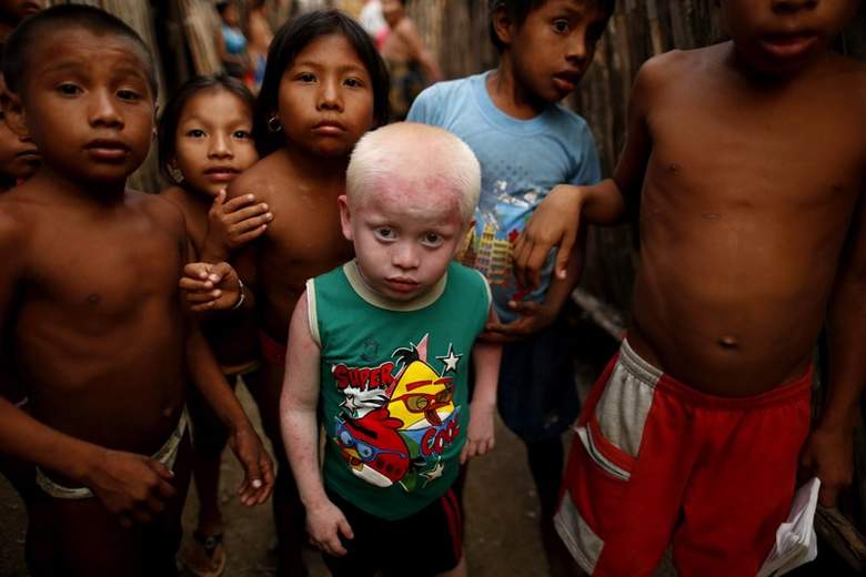 Загадки человека, Панама, альбинос, альбиносы
