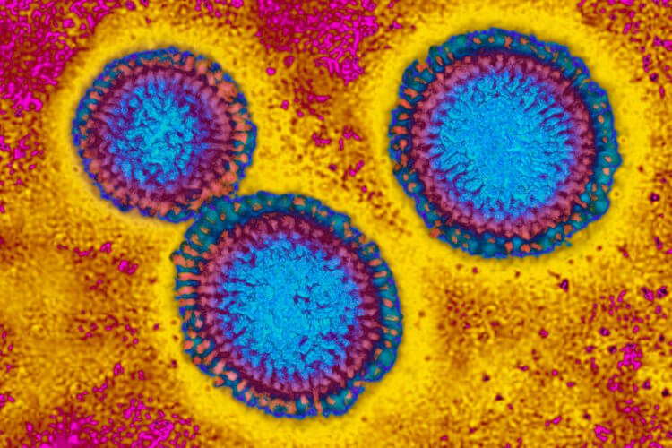 Вирус гриппа под микроскопом. Его диаметр колеблется примерно от 80 до