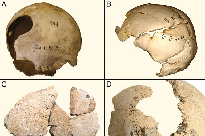 Примеры ударов тупым предметом по черепу эпохи неолита