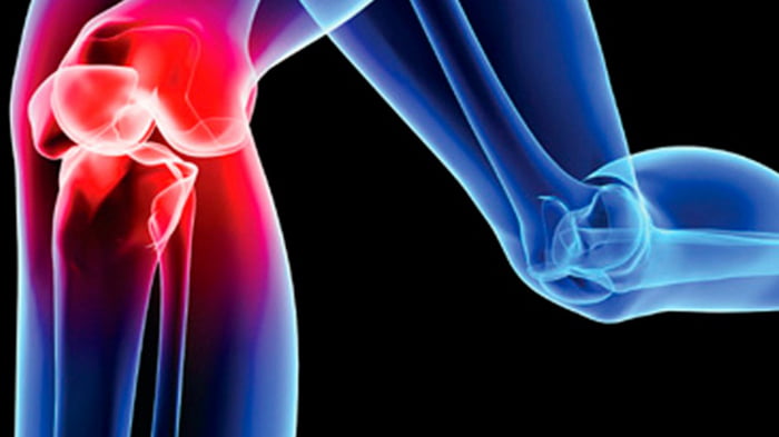 Как избавиться от боли в коленях?