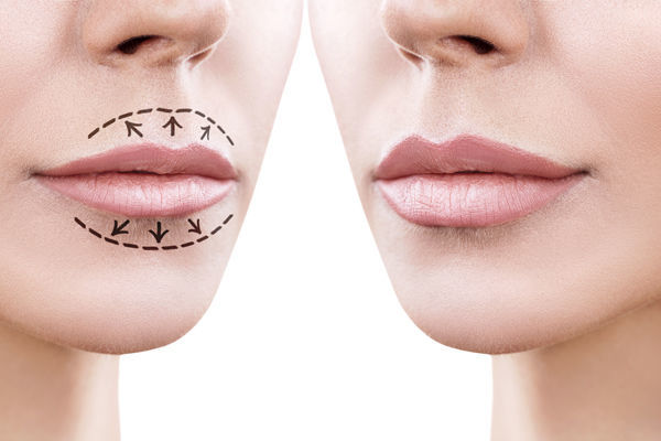 Как увеличить губы: народные методы?