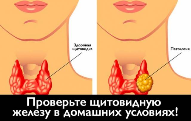 Проверьте щитовидную железу в домашних условиях