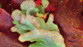 Карцинома кожи, рождающаяся из одной стволовой клетке в хвосте мыши