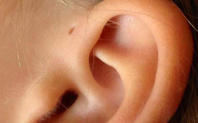 У каждого сотого британца обнаружено необъяснимое отверстие в ушах