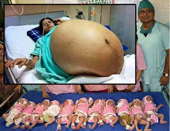 Женщина родила 11 детей без кесарева сечения!