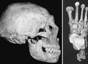 Древние хирурги: удивительные факты