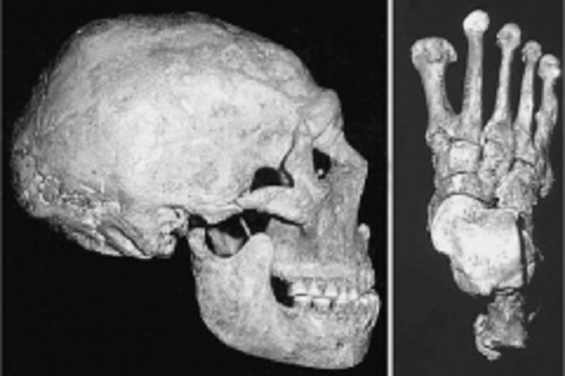 Древние хирурги: удивительные факты